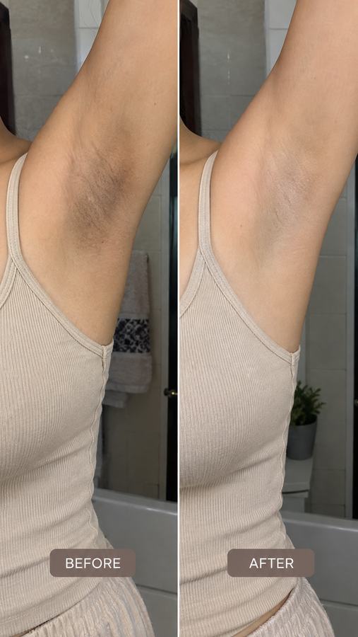 نتيجة قبل وبعد مع Bikini Butter