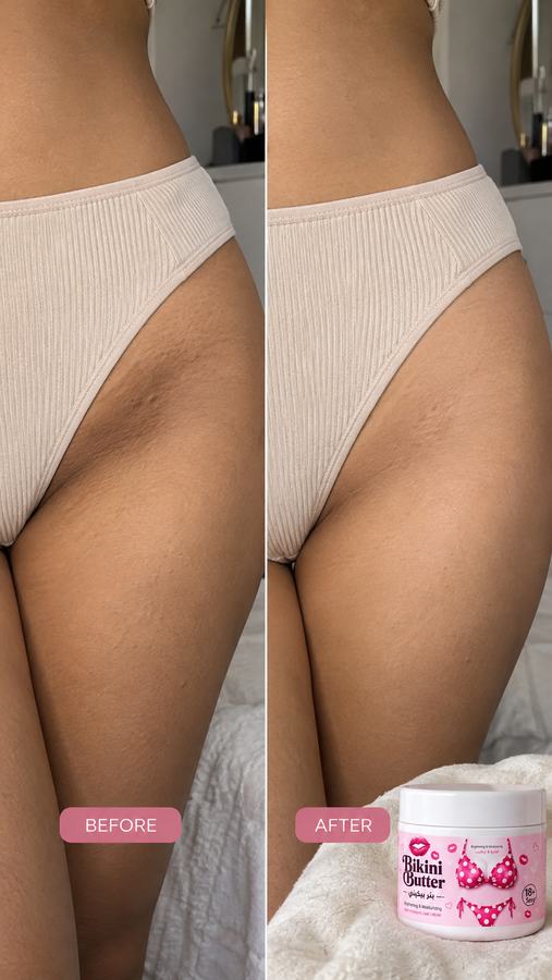 نتيجة قبل وبعد مع Bikini Butter