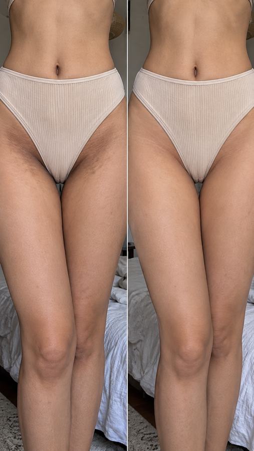 نتيجة قبل وبعد مع Bikini Butter